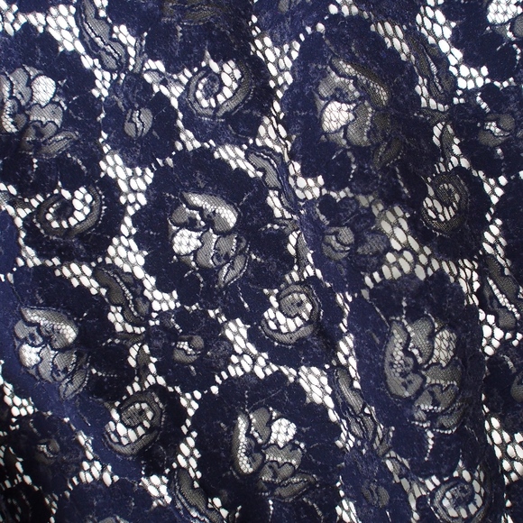 Tory Burch Adelaide Lace Dress Runway 2018- XS - Picture 6 of 7